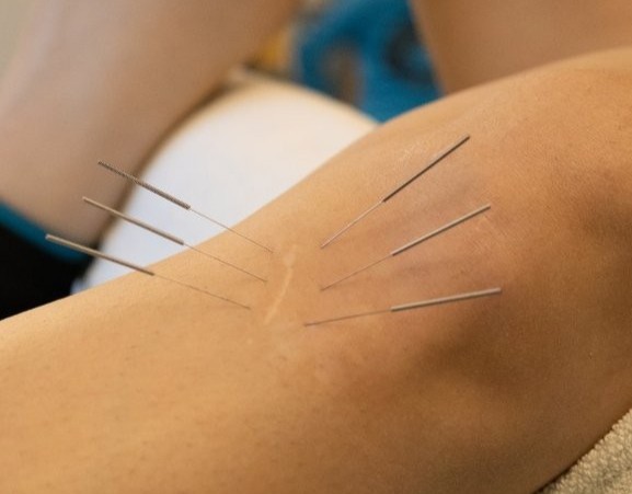 Foto Therapieangebot